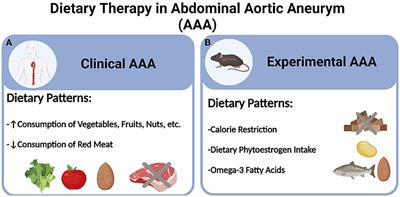 Dietary therapy in abdominal aortic aneurysm — Insights from clinical and experimental studies